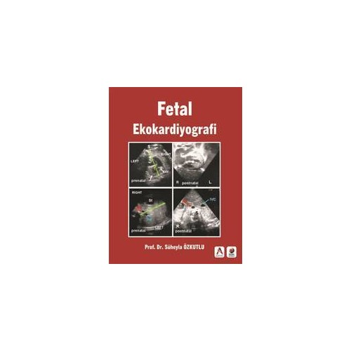 Fetal Ekokardiyografi